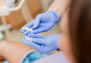 Dentist showing porcelain veneers to the patient. Close-up. Selective focus. Focus on crowns.