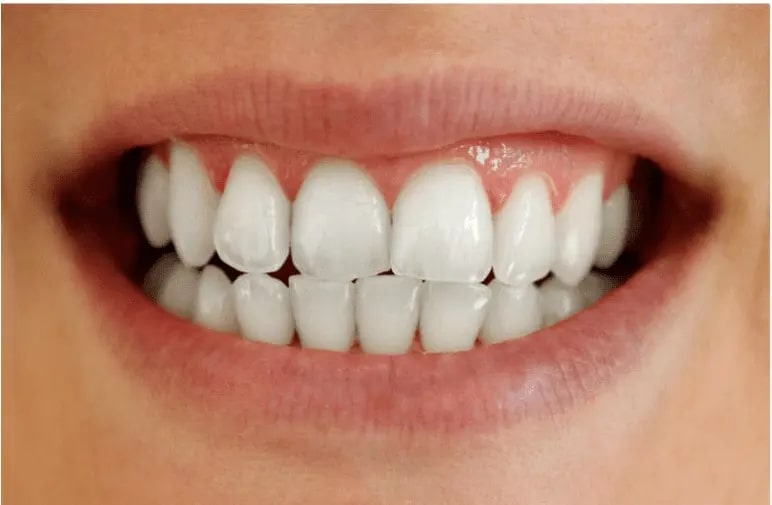 person smiling with their teeth exposed