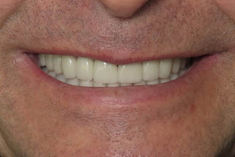 After Image