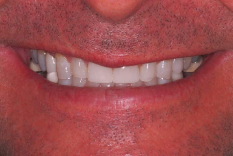 Before Image