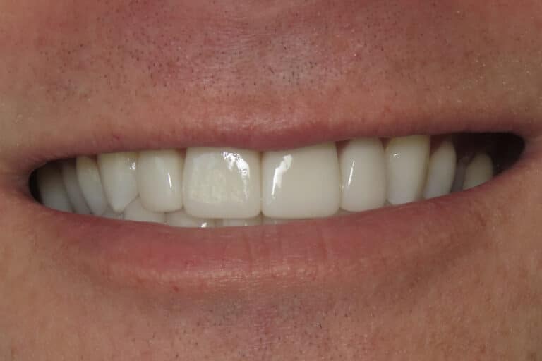 After Image