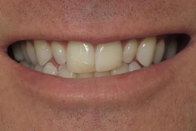 Before Image