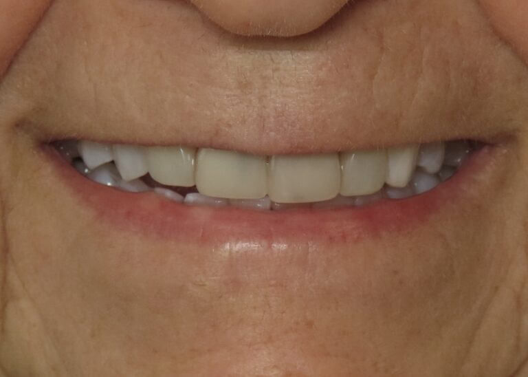 Before Image