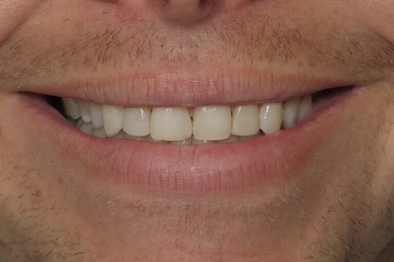 Before Image