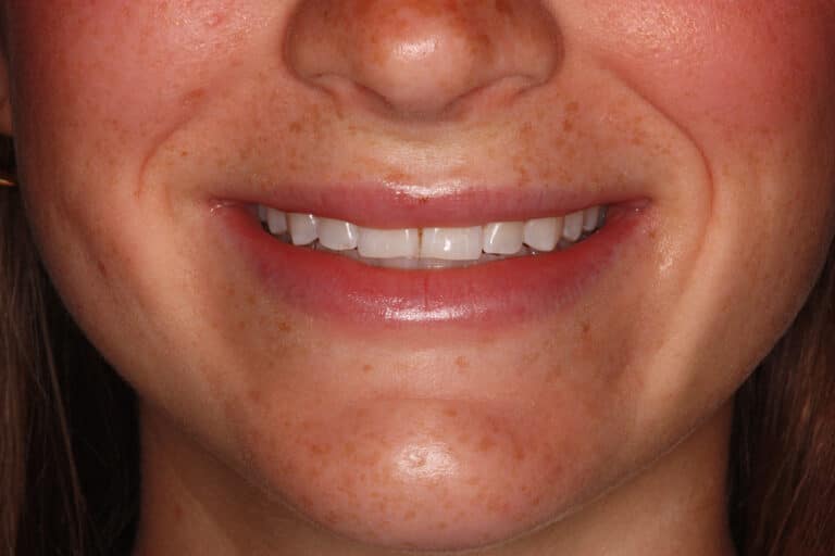 Before Image