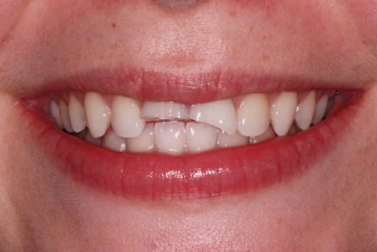 Before Image