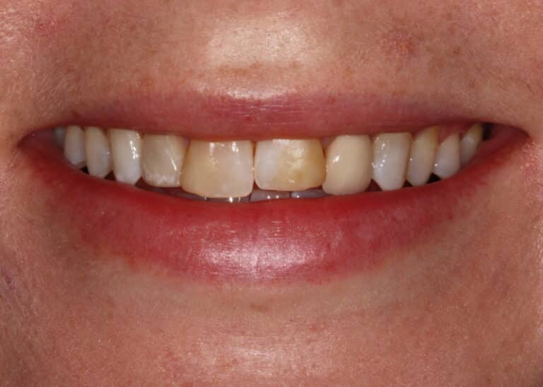 Before Image