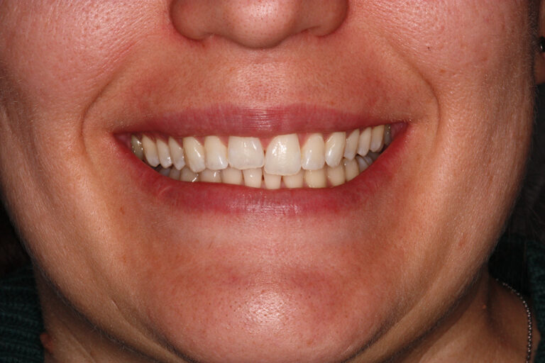 Before Image