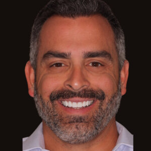 Joe