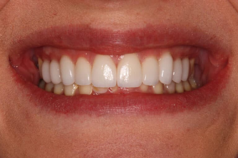 After Image