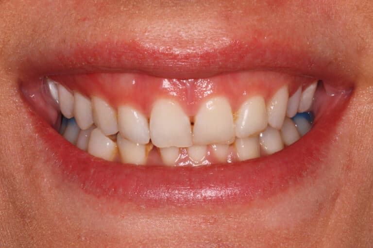 Before Image