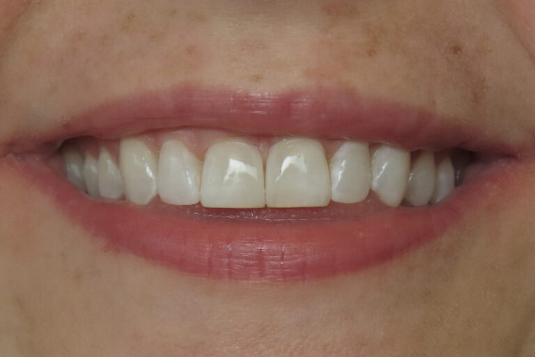 After Image