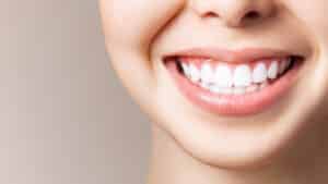 A close-up shot of a woman smiling after a full smile makeover in Phoenix